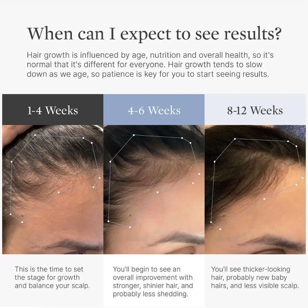 Superpower Thickening Hairpatches - Gold